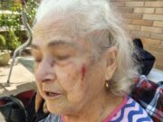 Una dona de 80 anys acaba ensangonada a Parets per culpa d’una vorera en mal estat